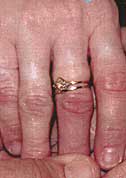 Finger results